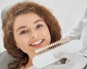veneers